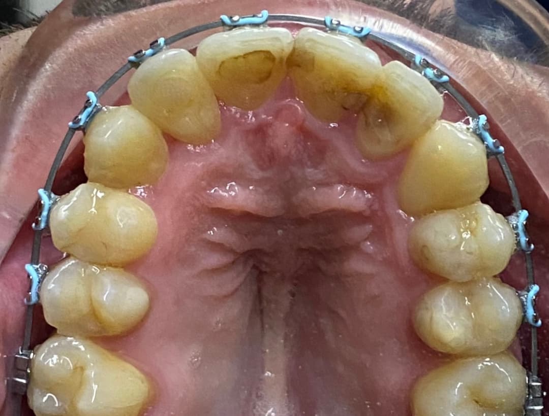 After image
