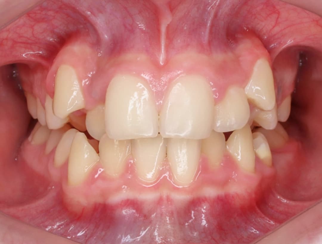 Before image